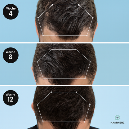 Haarherz® - Capirex